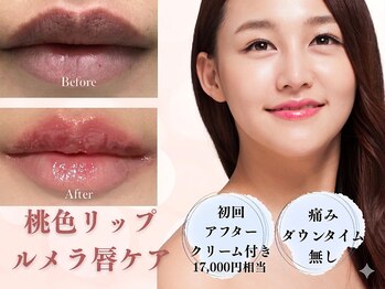 ギンザ111 プライベートルーム(Ginza 111 Private room)の写真/都内最安値?!韓国シェアNo1！ルメラ唇ケアで黒ずみ解消、目指すは桃色リップ♪