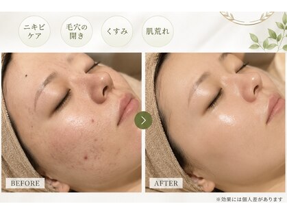 クレセント(CRESCENT)の写真