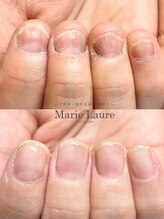 マリーロール 梅田店(Marie Laure)/自爪育成/深爪矯正/ネイルケア