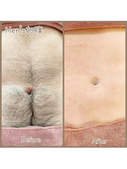 ココ(KoKo)/気になる箇所はどこでもWAX