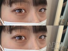 アペル(APPEL)/パリジェンヌ