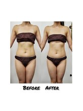 エミット(emit.)/くびれる整体　ビフォーアフター