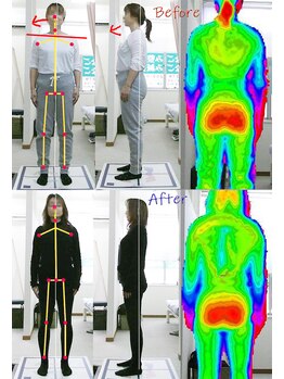 姫路なごみ整体院 なごみ鍼灸院/(改善例)右股関節の違和感