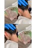 【大人気メニュー】フェイスワックス脱毛＋うなじワックス脱毛