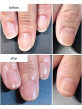 ケアプラス(care plus)/ハンドネイルケア