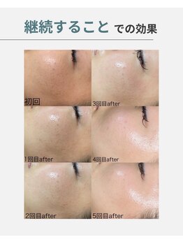 オフモード(OffMode)/みるみる見違える肌へ