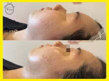 ヴィオール 名古屋栄店(VIOR)/＊人からも気づかれる変化＊