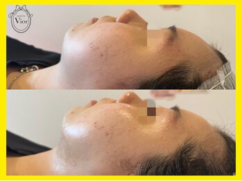 ヴィオール 名古屋栄店(VIOR)/*人からも気づかれる変化*