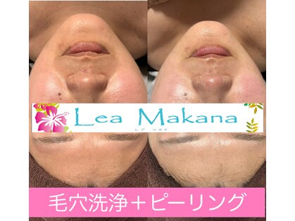 レアマカナ(LeaMakana)の写真
