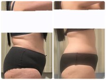 シャイン(SHINE)/