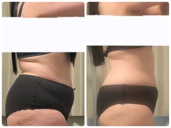 シャイン(SHINE)/