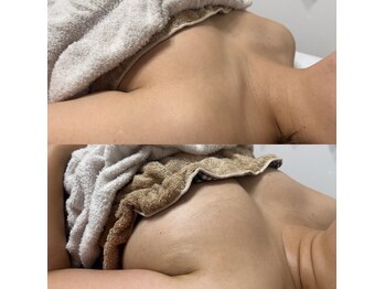 韓国式肌質改善・バストケアサロンKaela【4月 NEW OPEN(予定)】の写真/【結果重視の肌質改善&バストアップ専門サロン】本気で自分を変えたい方のために!