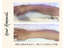 リンダ 白金台(linda)の雰囲気（1回毎に支払いの都度払い/結果に自信があります※男性完全紹介制）
