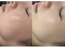 シャルムパリス(charme paris)の雰囲気（【諦めていた肌もご相談ください】赤み/痒み/乾燥肌/敏感肌）