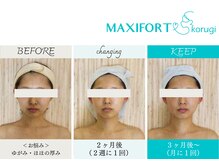 コルギ専門店 マキシフォート 栄店(Maxifort)/お客さまからの感想