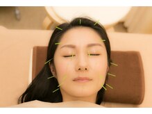 ゆらうみ鍼灸接骨院/美顔鍼・美容鍼