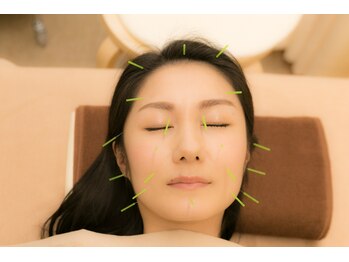 ゆらうみ鍼灸接骨院/美顔鍼・美容鍼