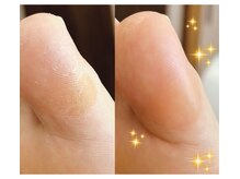 アベビー(Abeby)の雰囲気（昔からココが固くなる…それは姿勢や歩き方改善で変わるかも◎）