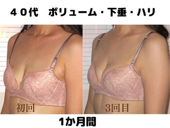 バストサロン メルベイユ(Merveile)/バスト位置、ボリュームUP