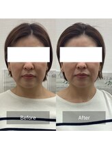 ハリナチュレ 那覇店(HARINATURE)/Before/After