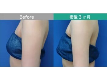 スリー 桜木町(Three)/二の腕【桜木町/横浜/関内】