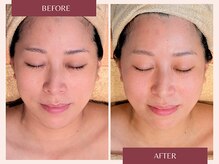 トリプルサンショップ 京都店/【極上フェイシャルスペシャル】