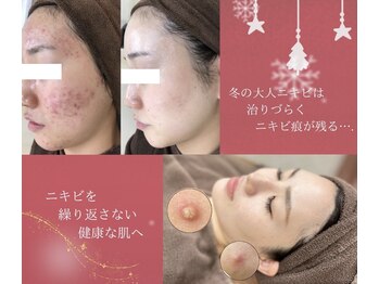 エピア 半田店(Epia)