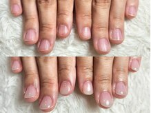 グラシナ なんば店/深爪/自爪育成/フィルイン