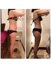 グレイスボディ BiViつくば店(Grace Body)/◆痩身　症例写真