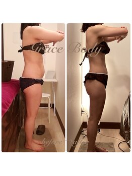 グレイスボディ BiViつくば店(Grace Body)/◆痩身　症例写真