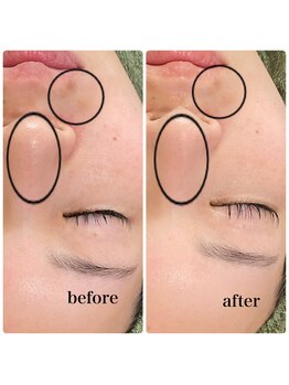 ラシック(Rachic)/細胞復元パック