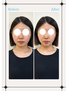 優頭(yuzu)/脱マスクに向けて！