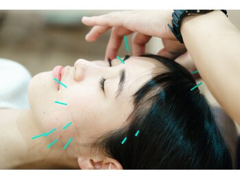 たたら鍼灸整骨院/サクッと美容鍼