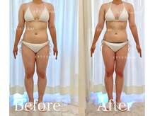 えすてさろん ケイアンドエフ(k&f)/体脂肪-4.0%/4ヶ月全身痩せ成功