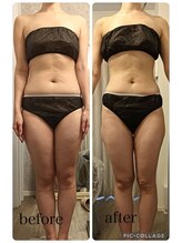 リープ(Lieb)/ボディビフォーアフター