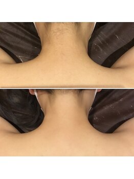 ユジュ(yju)の写真/【松戸駅1分】1回ごとの都度払いOK◎気になるパーツだけでも通いやすい、大人の美肌脱毛サロン♪