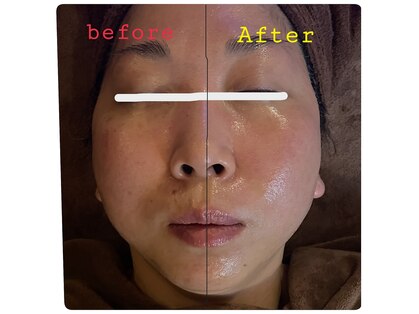 ヒーリングデトックス リラックリ(HealingDetox RELUCKRY)の写真