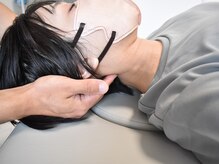 首肩こり/頭痛/眼精疲労/不眠◎お悩みに合わせて施術します!