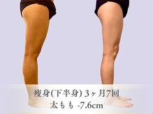 ベルペール(Belle perle)/【痩身】インドエステ