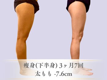 ベルペール(Belle perle)/【痩身】インドエステ