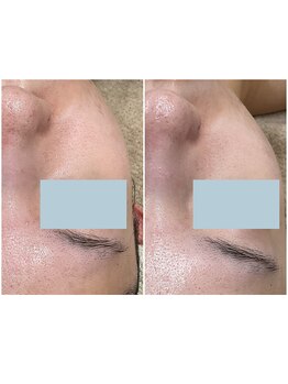 メイス 福井店(MEIS)/お客様before、after