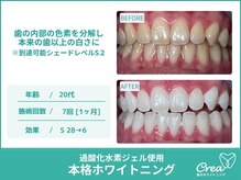 クレア(Crea)/【ホワイトニング症例写真】