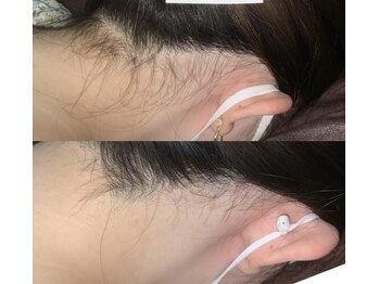 プリマ(Prima)/BEFORE&AFTER