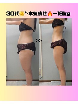 ルミルナ(Lumi Luna)/３０代ダイエット