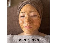 ハーブピーリングコース剥離なし◎植物由来の力で再生能力UP！