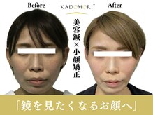 カドモリ 心斎橋(KADOMORI)