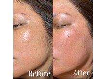 ジョエルワックス 沖縄那覇店(JOELLE WAX)/一度ツルツルお肌お試しください