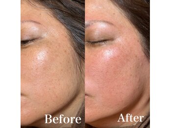 ジョエルワックス 沖縄那覇店(JOELLE WAX)/一度ツルツルお肌お試しください