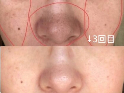 リザ(Rize)の写真