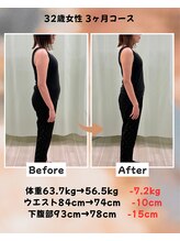 くさば整骨院/32歳女性/ダイエット3か月コース
